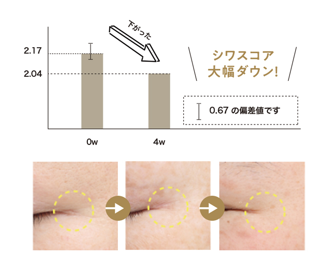 シワスコア大幅ダウン！